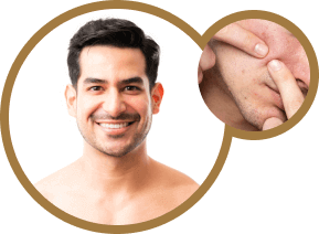 Clear, healthy skin